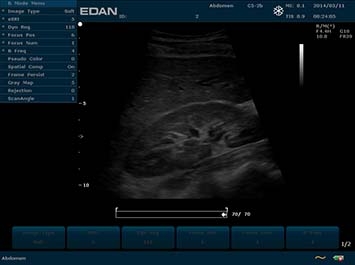 EDAN U2