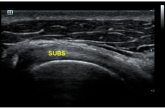 Mindray DC-60 Exp X-Insight