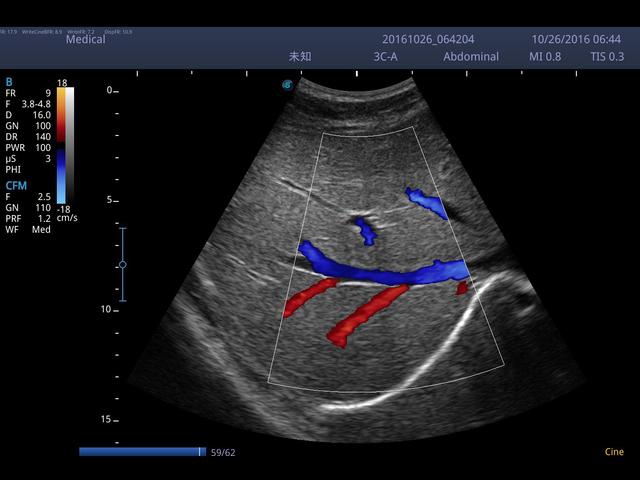 SonoScape S2N